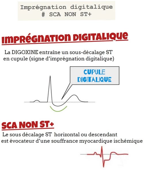 Imprégnation digitalique